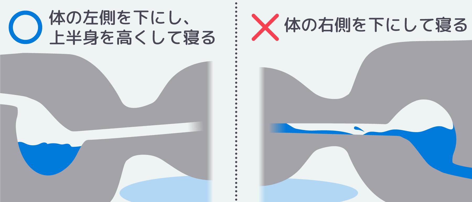 胃酸の動き図解イラスト